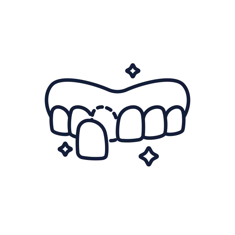 Dental Veneers Dental Veneers